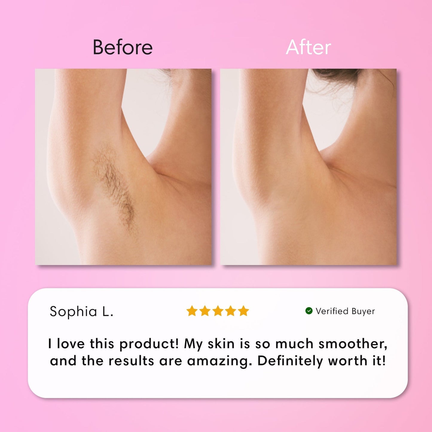 Flawless Skin Hair Removal Cream | Gentle 5-Minute Body Hair Removal