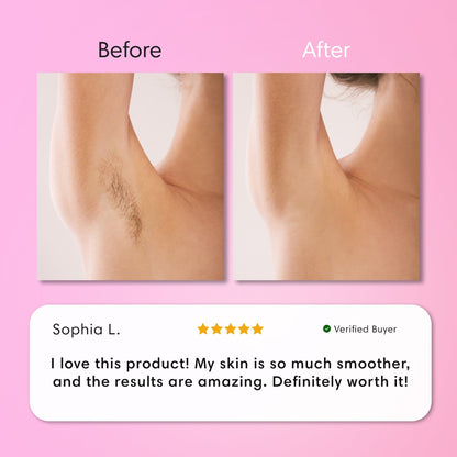Flawless Skin Hair Removal Cream | Gentle 5-Minute Body Hair Removal
