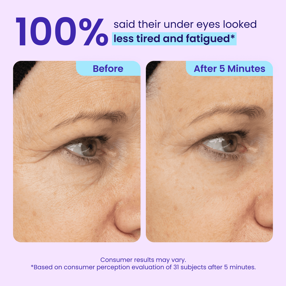 LOVILDS Instant Lift Eye Gel – For Eye Bags, Puffiness, Wrinkles, Fine Lines & Dark Circles🌱