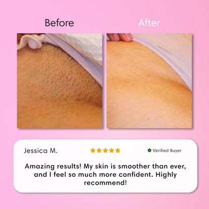 Flawless Skin Hair Removal Cream | Gentle 5-Minute Body Hair Removal