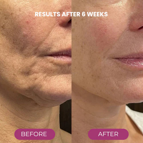 ✨ Buy More, Save More｜Smooth, Firm & Glow with Nexisify Multi Balm 💜