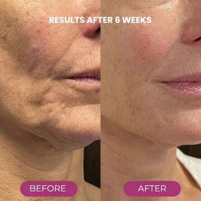 ✨ Buy More, Save More｜Smooth, Firm & Glow with Nexisify Multi Balm 💜