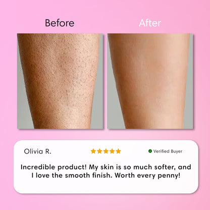 Flawless Skin Hair Removal Cream | Gentle 5-Minute Body Hair Removal