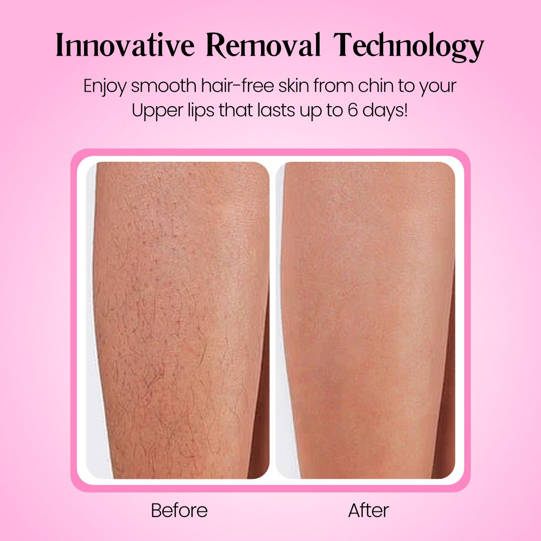Flawless Skin Hair Removal Cream | Gentle 5-Minute Body Hair Removal
