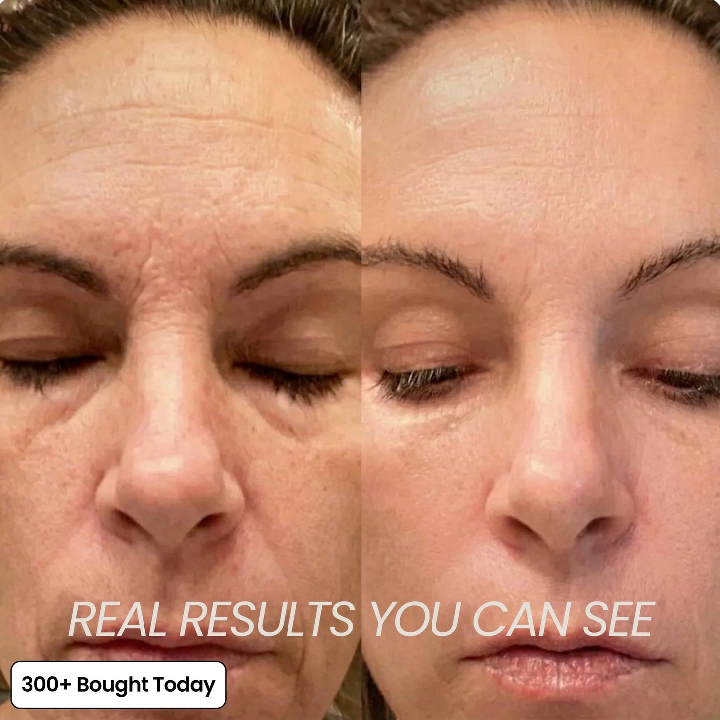 🔥LAST DAY 60% OFF Niteora Korean Pink CollagenVolume Multi Balm