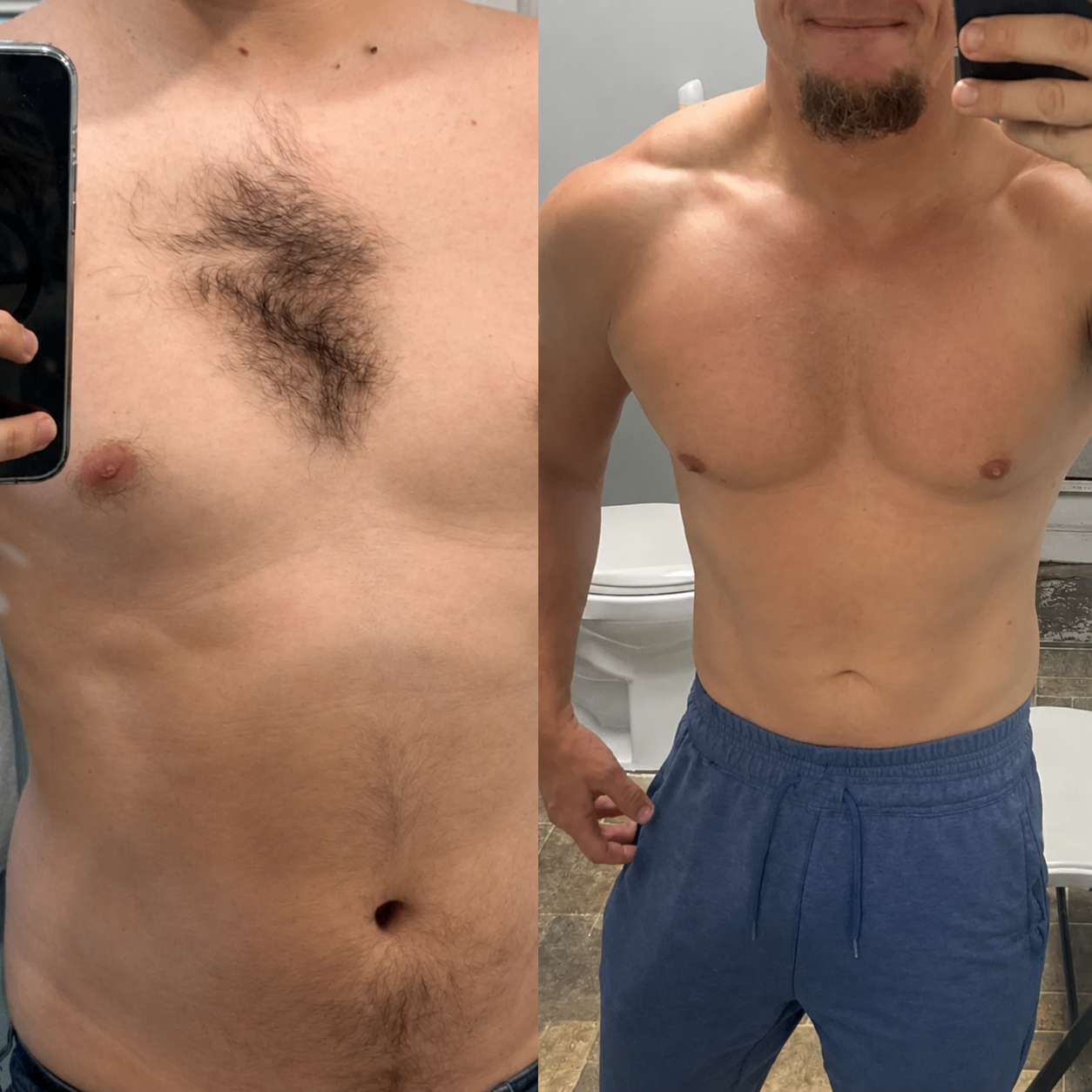 Flawless Skin Hair Removal Cream | Gentle 5-Minute Body Hair Removal