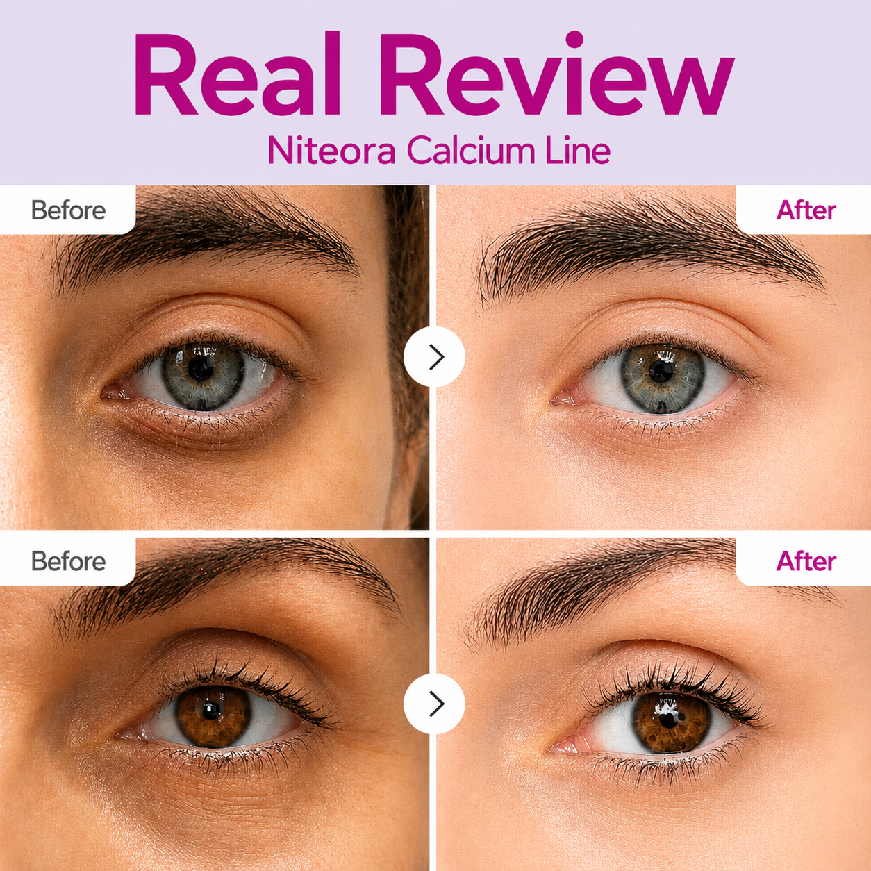 🔥LAST DAY 50% OFF!!Niteora Korean Calcium Dark Spot Eye Cream