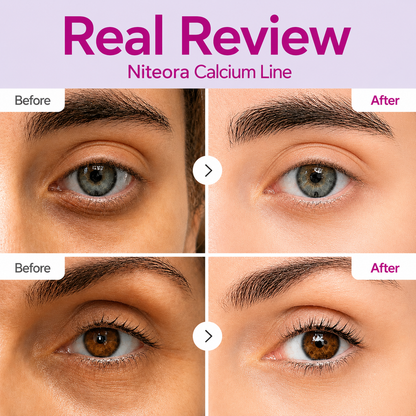 🔥LAST DAY 50% OFF!!Niteora Korean Calcium Dark Spot Eye Cream