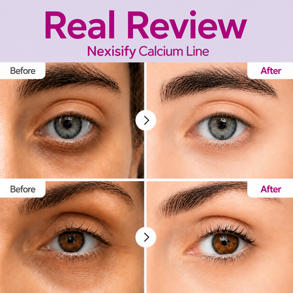 🔥LAST DAY 50% OFF!!Nexisify Korean Calcium Dark Spot Eye Cream.