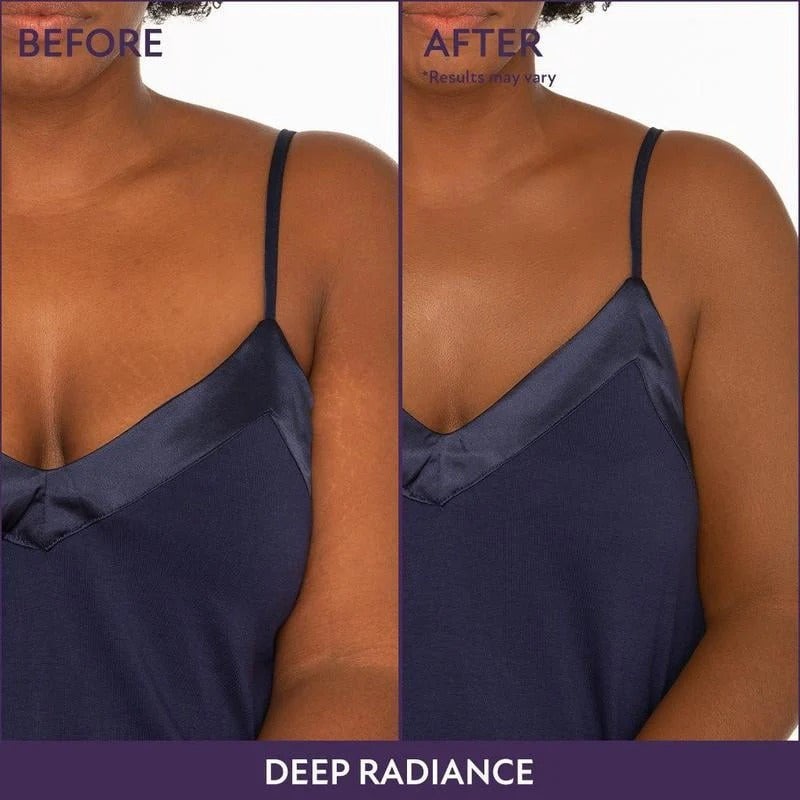 💜Last Day-Buy 1 Get 1 Free!💜✨Body Coverage Perfector – Waterproof, Lightweight & Flawless Body Makeup